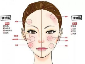 如何解决激素脸修复过程中出现的反跳现象高级皮肤管理师赵健彤分享